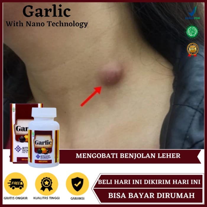 Obat Herbal Benjolan Di Leher Solusi Alami?