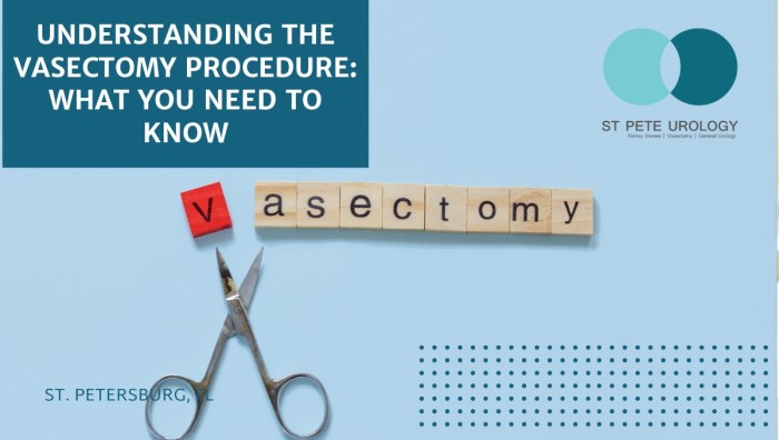 Vasectomy Apa Itu Vasektomi? Ini Pengertian, Prosedur, dan Manfaatnya
