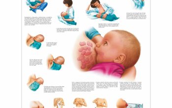 6 Rekomendasi Dot Terbaik untuk Bayi Susah Ngedot